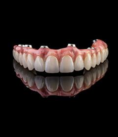 implant dentures with a black background